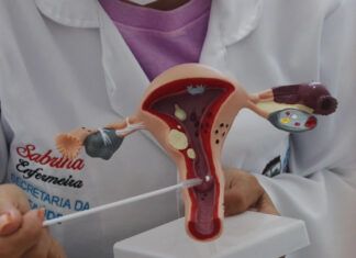 Exames preventivos serão realizados em todas as unidades de Penha neste sábado