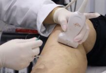 Saúde de Penha oferta inovador tratamento para varizes
