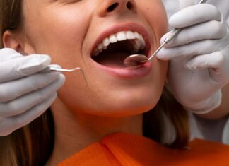 Seleção de Jovens para Tratamento Dentário Gratuito em Barra Velha